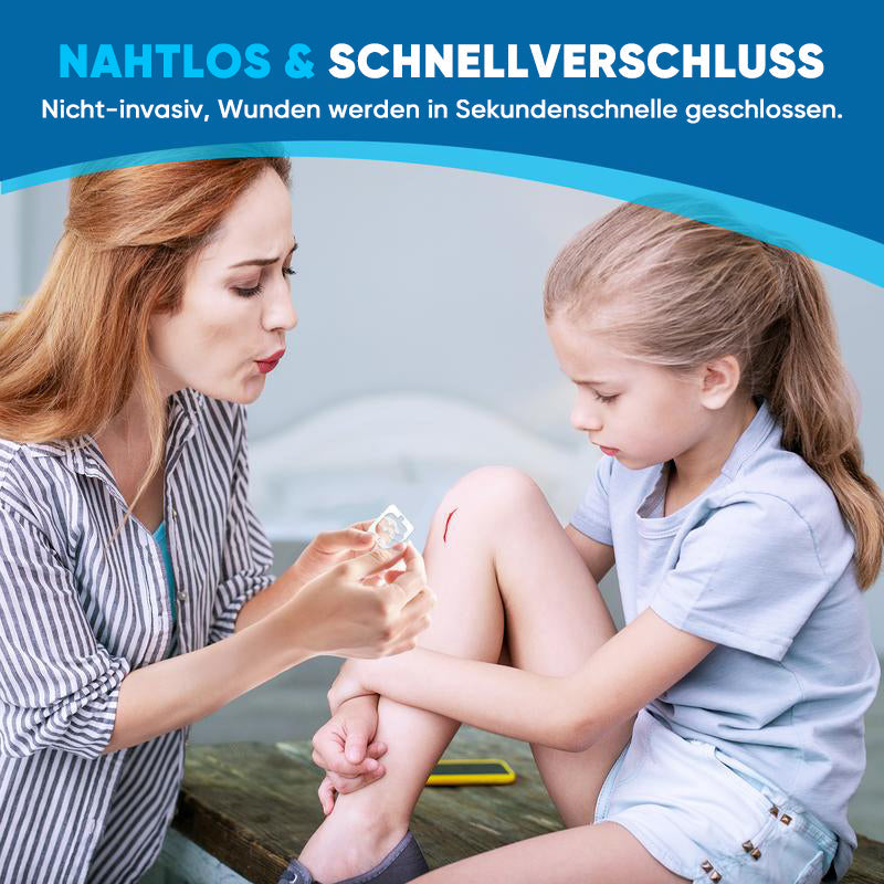 Wundverschlussstreifen ohne Nähen (2 Riemen x 2 Stück/Karton)