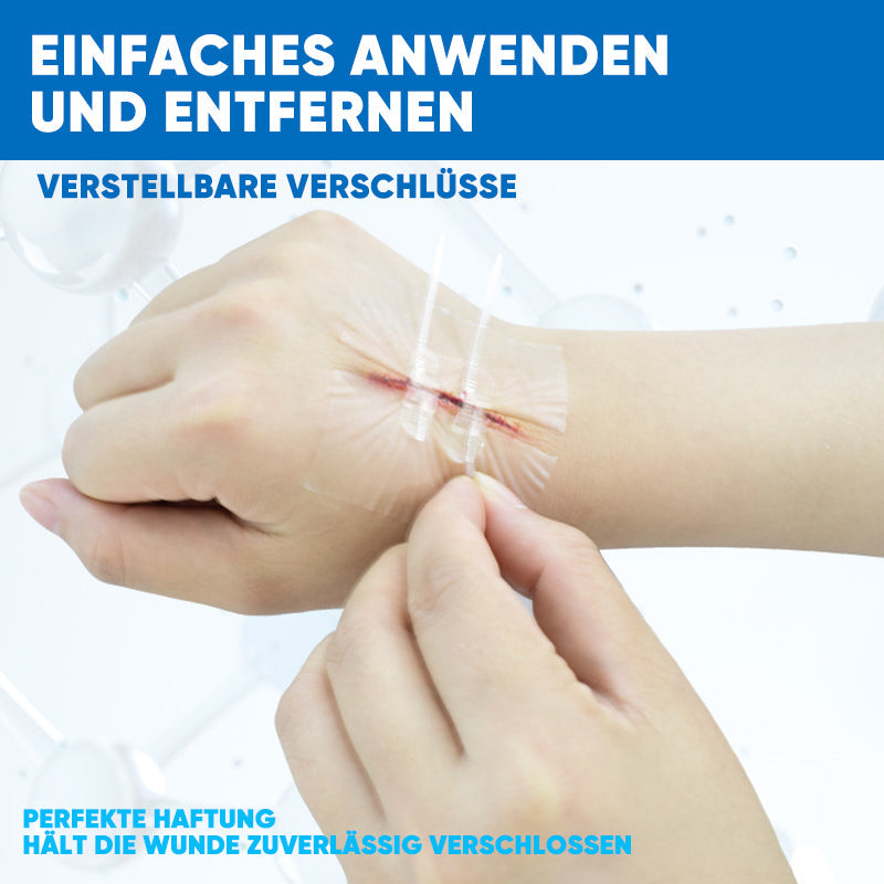 Wundverschlussstreifen ohne Nähen (2 Riemen x 2 Stück/Karton)