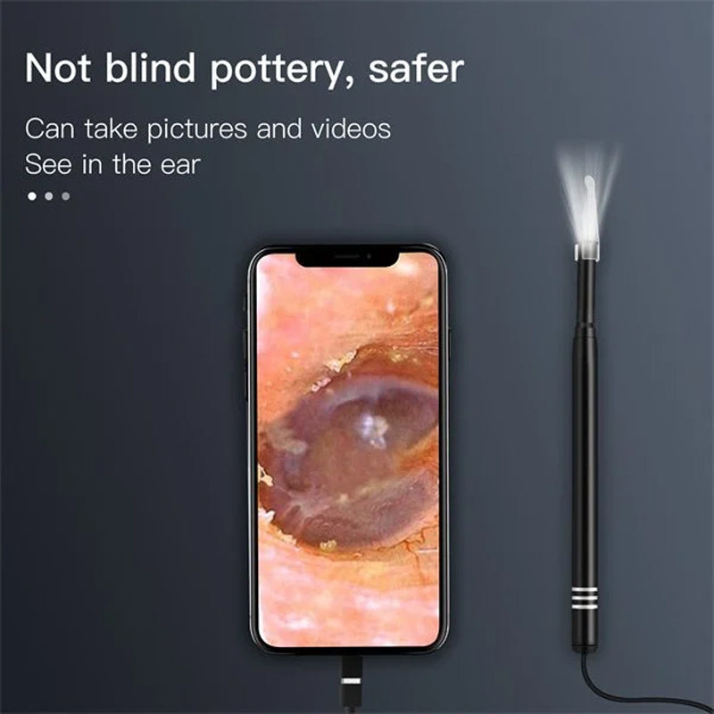 Freietaube Ear Cleaner with Camera