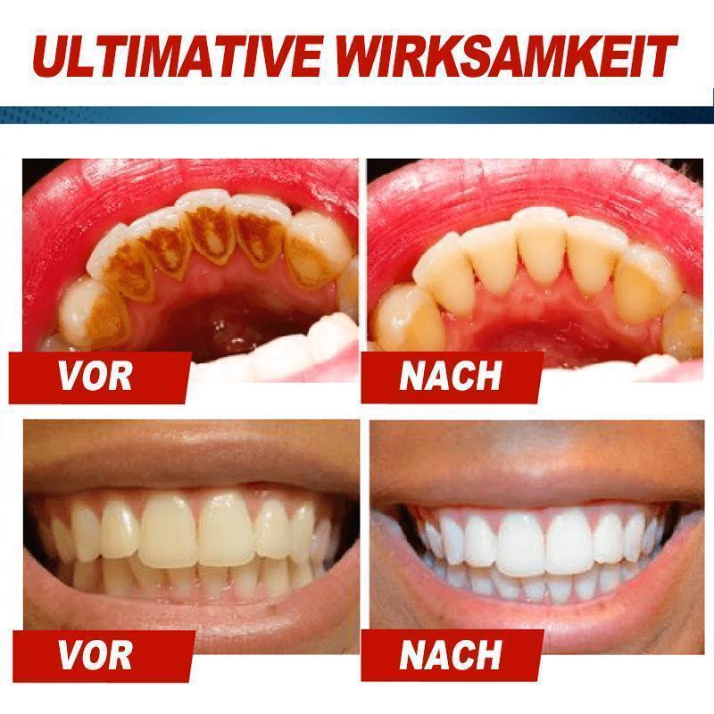 Intensive Fleckenentfernung Whitening Zahnpasta